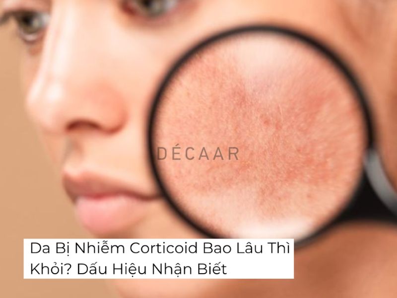 da bị nhiễm corticoid bao lâu thì khỏi